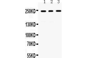 Western Blotting (WB) image for anti-Protein Tyrosine Phosphatase Receptor Type F (PTPRF) (AA 1167-1203), (Middle Region) antibody (ABIN3043915) (PTPRF antibody  (Middle Region))