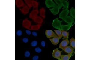 ABIN6262161 and ABIN6266557 staining Hela cells(24h of starvation treatment) by IF/ICC. (HCG beta antibody  (Internal Region))