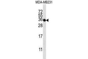 Western Blotting (WB) image for anti-Taste Receptor, Type 2, Member 1 (TAS2R1) antibody (ABIN2997059) (TAS2R1 antibody)