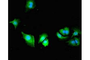 Immunofluorescent analysis of MCF-7 cells using ABIN7163564 at dilution of 1:100 and Alexa Fluor 488-congugated AffiniPure Goat Anti-Rabbit IgG(H+L) (Plastin 3 antibody  (AA 310-455))