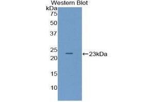Western Blotting (WB) image for anti-Pituitary Adenylate Cyclase Activating Peptide (AA 1-175) antibody (ABIN1857915) (Pituitary Adenylate Cyclase Activating Peptide (AA 1-175) antibody)