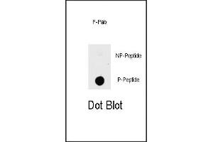 Dot blot analysis of anti-K1-p Phospho-specific b (ABIN389799 and ABIN2839695) on nitrocellulose membrane. (PAK1 antibody  (pThr423))