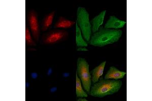 ABIN6261180 and ABIN6278834 staining  cells by IF/ICC. (COX1 antibody  (C-Term))
