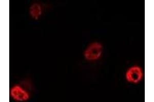 Immunofluorescent analysis of YT521-B staining in MCF7 cells.