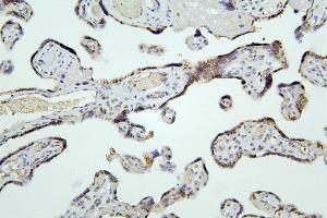 IHC analysis of HDAC5 using anti-HDAC5 antibody (ABIN7599922). (HDAC5 antibody  (AA 13-1107))