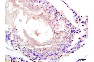 Formalin-fixed and paraffin embedded rat testis labeled with Anti-LDHC/Cancer,testis antigen 32 Polyclonal Antibody, Unconjugated (ABIN704696) at 1:200 followed by conjugation to the secondary antibody and DAB staining. (Lactate Dehydrogenase C antibody  (AA 231-332))