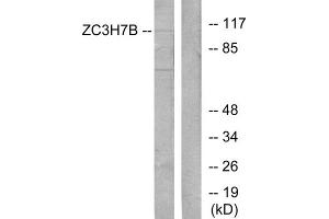 Western blot analysis of extracts from 293 cells, using ZC3H7B antibody. (ZC3H7B antibody  (C-Term))