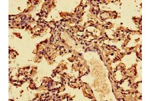 Immunohistochemistry of paraffin-embedded human lung tissue using ABIN7156561 at dilution of 1:100 (IFNA2 antibody  (AA 24-188))