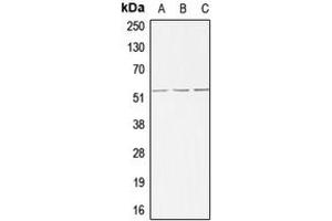 Western blot analysis of ALK1 expression in MCF7 (A), mouse liver (B), rat liver (C) whole cell lysates. (ACVRL1 antibody  (Center))