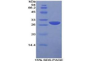 SDS-PAGE analysis of Human SLAMF1 Protein.