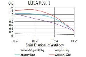 Black line: Control Antigen (100 ng), Purple line: Antigen(10 ng), Blue line: Antigen (50 ng), Red line: Antigen (100 ng), (SIRT6 antibody  (AA 141-250))