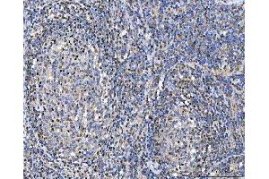 IHC analysis of Glutathione Reductase using anti-Glutathione Reductase antibody (ABIN5693151). (Glutathione Reductase antibody  (AA 256-522))