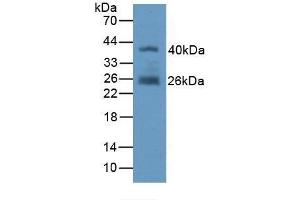 Detection of Recombinant FAPa, Human using Polyclonal Antibody to Fibroblast Activation Protein Alpha (FAPa) (FAP antibody  (AA 523-760))