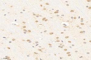 Immunohistochemistry analysis of paraffin-embedded rat brain using,SMAD9 (ABIN7075625) at dilution of 1: 800