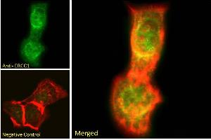 ABIN6391360 Immunofluorescence analysis of paraformaldehyde fixed A431 cells, permeabilized with 0.
