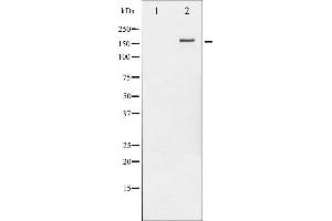 ErbB2/Her2 antibody  (pTyr877)