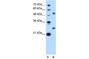 WB Suggested Anti-BCL2L1 Antibody Titration: 2. (BCL2L1 antibody  (N-Term))