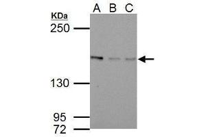 WB Image Sample (30 ug of whole cell lysate)          A: NIH-3T3         B: JC         C: BCL-1         5% SDS PAGE          antibody diluted at 1:1000          (BLM antibody  (C-Term))