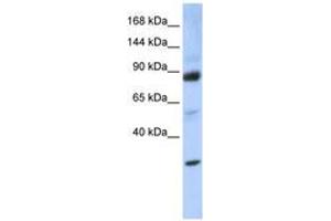 Image no. 1 for anti-Zinc Fingers and Homeoboxes 3 (ZHX3) (AA 864-913) antibody (ABIN6744228) (ZHX3 antibody  (AA 864-913))