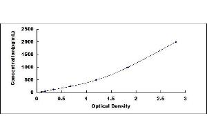 Typical standard curve (Glutamate Receptor 1 ELISA Kit)