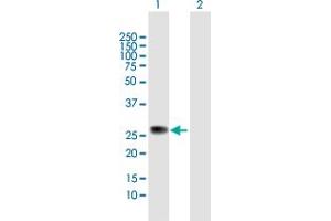 ZC4H2 antibody  (AA 1-224)