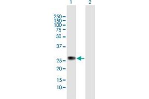 Western Blot analysis of ZC4H2 expression in transfected 293T cell line by ZC4H2 MaxPab polyclonal antibody. (ZC4H2 antibody  (AA 1-224))