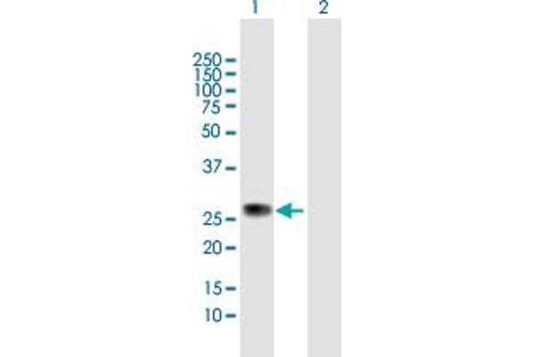 ZC4H2 antibody  (AA 1-224)