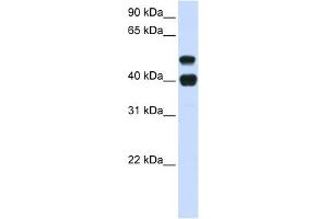 USP22 antibody used at 1 ug/ml to detect target protein. (USP22 antibody  (N-Term))
