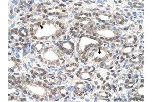 Image no. 1 for anti-Deafness, Autosomal Dominant 5 (DFNA5) (AA 342-391) antibody (ABIN321047) (DFNA5 antibody  (AA 342-391))
