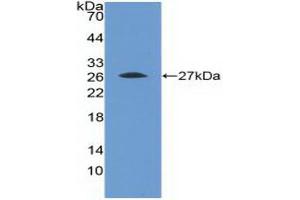 Detection of Recombinant FGFR4, Human using Polyclonal Antibody to Fibroblast Growth Factor Receptor 4 (FGFR4) (FGFR4 antibody  (AA 168-369))