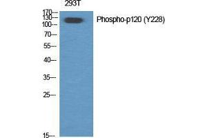 Western Blot (WB) analysis of specific cells using Phospho-p120 (Y228) Polyclonal Antibody. (CTNND1 antibody  (pTyr228))