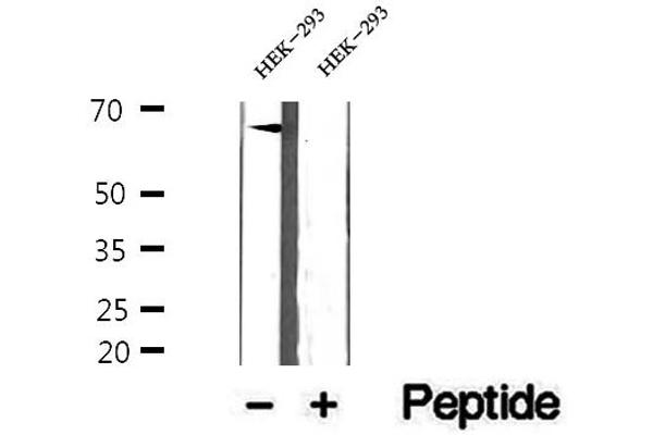 ETFDH antibody  (C-Term)