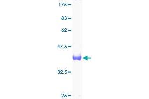 UBE2D3 Protein (AA 1-147) (GST tag)