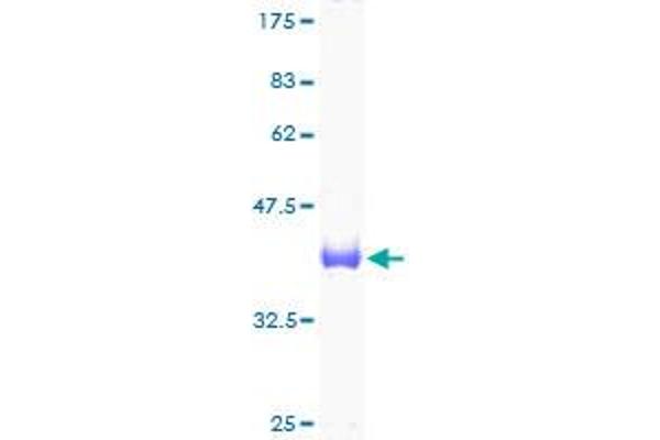 UBE2D3 Protein (AA 1-147) (GST tag)