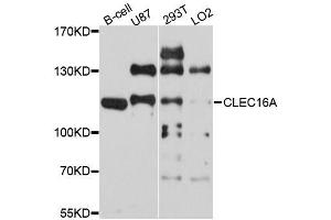 Western blot analysis of extracts of various cell lines, using CLEC16A antibody (ABIN5996330) at 1/1000 dilution.