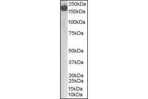 Image no. 2 for anti-Complement Factor H (CFH) (Internal Region) antibody (ABIN372860) (Complement Factor H antibody  (Internal Region))