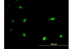 Immunofluorescence of monoclonal antibody to IRX3 on HeLa cell. (IRX3 antibody  (AA 182-285))