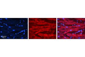 Rabbit Anti-EWSR1 Antibody   Formalin Fixed Paraffin Embedded Tissue: Human heart Tissue Observed Staining: Cytoplasmic, plasma membrane Primary Antibody Concentration: 1:100 Other Working Concentrations: 1:600 Secondary Antibody: Donkey anti-Rabbit-Cy3 Secondary Antibody Concentration: 1:200 Magnification: 20X Exposure Time: 0. (EWSR1 antibody  (Middle Region))