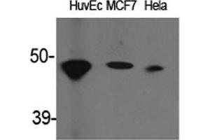 Western Blot (WB) analysis of specific cells using ACAT-1 Polyclonal Antibody. (SOAT1 antibody  (Internal Region))