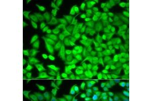 Immunofluorescence analysis of MCF-7 cells using FBP1 Polyclonal Antibody (FBP1 antibody)