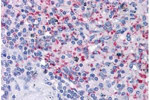 Human Spleen: Formalin-Fixed, Paraffin-Embedded (FFPE) (Integrin beta 3 antibody)