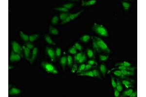 Immunofluorescent analysis of Hela cells using ABIN7169412 at dilution of 1:100 and Alexa Fluor 488-congugated AffiniPure Goat Anti-Rabbit IgG(H+L) (SETD5 antibody  (AA 519-700))