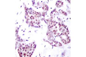 Immunohistochemistry (IHC) image for anti-Signal Transducer and Activator of Transcription 6, Interleukin-4 Induced (STAT6) (pTyr641) antibody (ABIN1870652) (STAT6 antibody  (pTyr641))