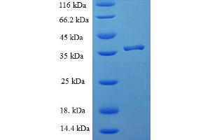 ICT1 Protein (AA 30-206) (His-SUMO Tag)