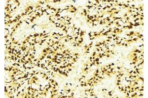 ABIN6277637 at 1/100 staining Human lung tissue by IHC-P.