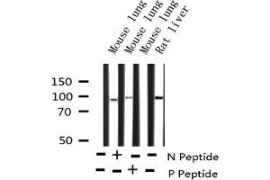 Western blot analysis of Phospho-STAT5B (Ser731) expression in various lysates (STAT5B antibody  (pSer731))