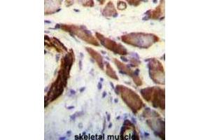 Immunohistochemistry (IHC) image for anti-Filamin A, alpha (FLNA) antibody (ABIN3003482) (Filamin A antibody)
