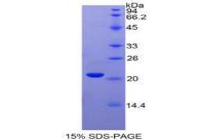 SDS-PAGE analysis of Human Interferon alpha 4 Protein. (IFNA4 Protein)