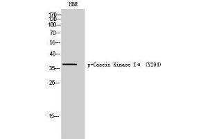 Western Blotting (WB) image for anti-Casein Kinase 1, alpha 1 (CSNK1A1) (pTyr294) antibody (ABIN3182662)