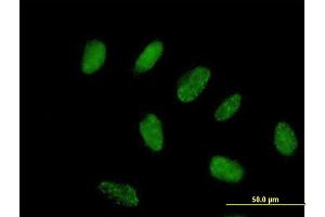 Immunofluorescence of purified MaxPab antibody to FLJ38288 on HeLa cell. (ZNF776 antibody  (AA 1-476))